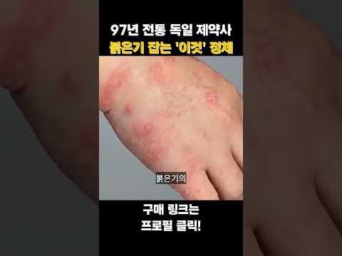 세라일론 수딩밤 써보니! 피부 장벽 강화로 건강 되찾았어요