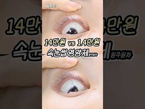 올영템 고가 속눈썹 영양제 1주 비교 건강한 속눈썹 성장 후기